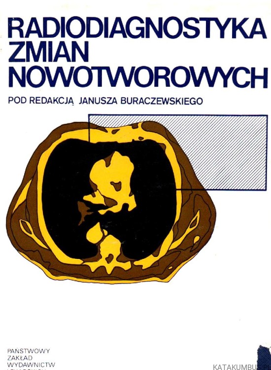 Radiodiagnostyka zmian nowotworowych. RED. JANUSZ BURACZEWSKI